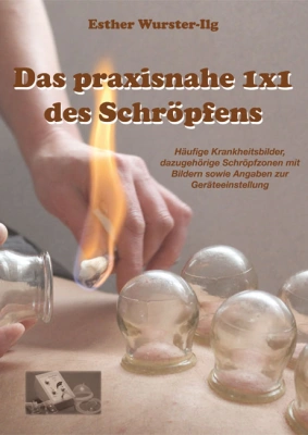 Das praxisnahe 1 x 1 des Schröpfens